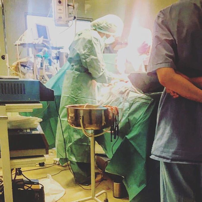 C-section