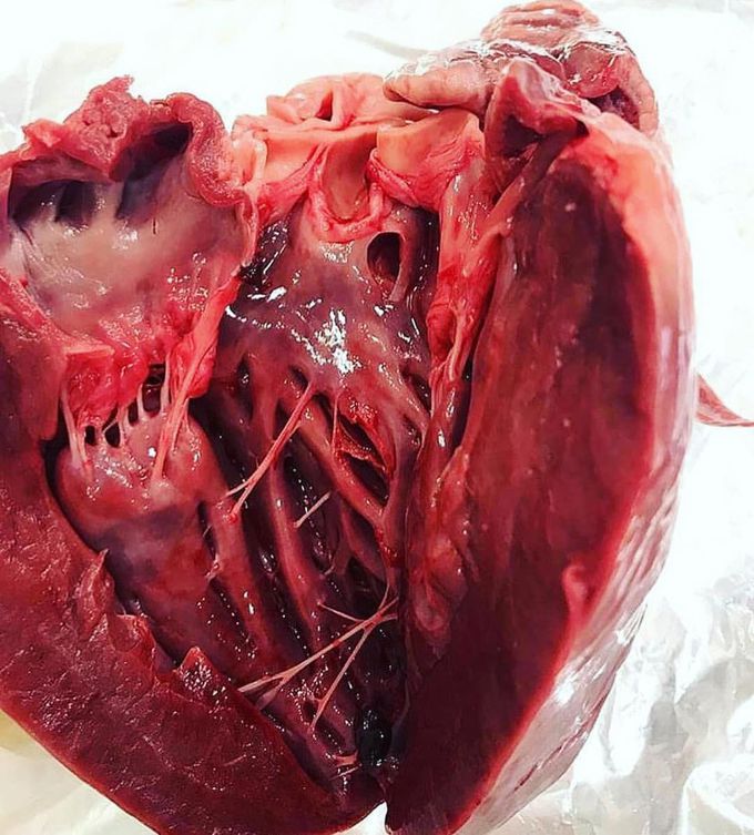 This is a very unique view of the heart! 