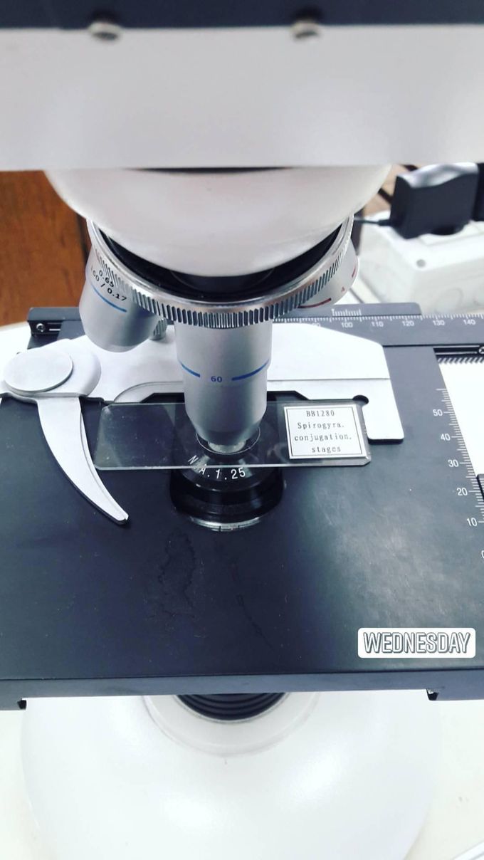 Spirogyra Conjugation Stages