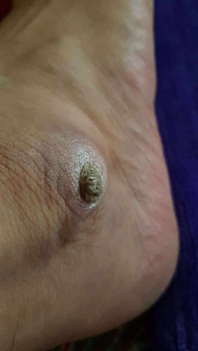 Diagnosis?