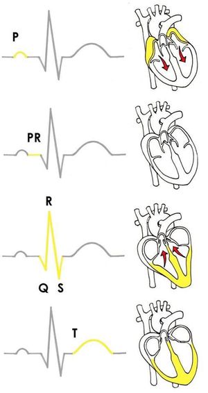 The ECG localisation - MEDizzy