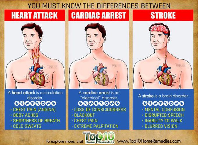 Difference's Between a Heart Attack, Cardiac Arrest and a Stroke