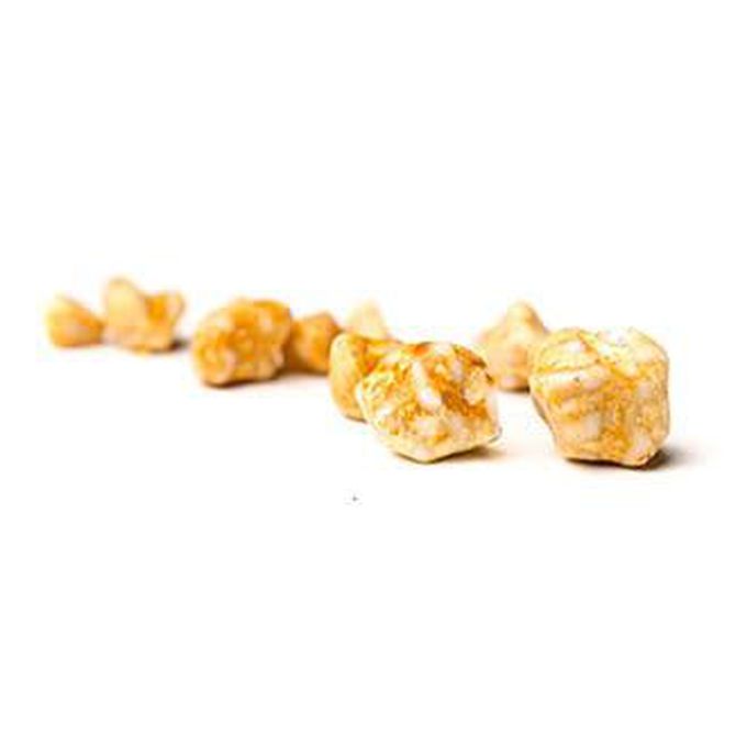 Gallstones