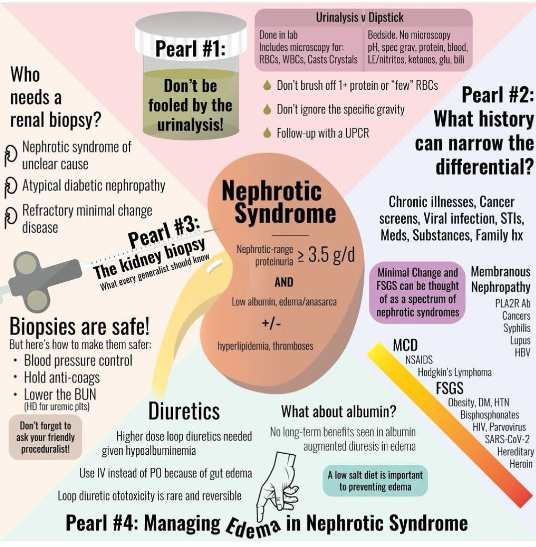 Edema in Nephrotic Syndrome - MEDizzy