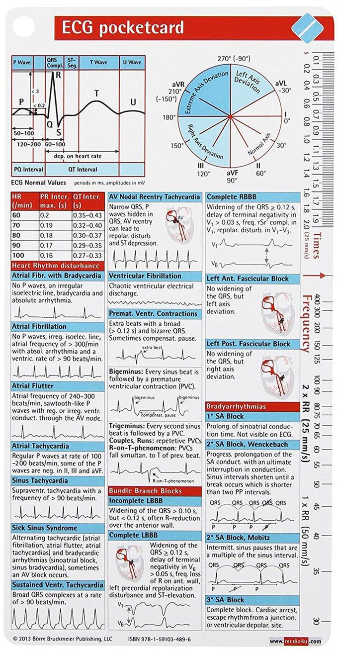 ECG pocketcard!