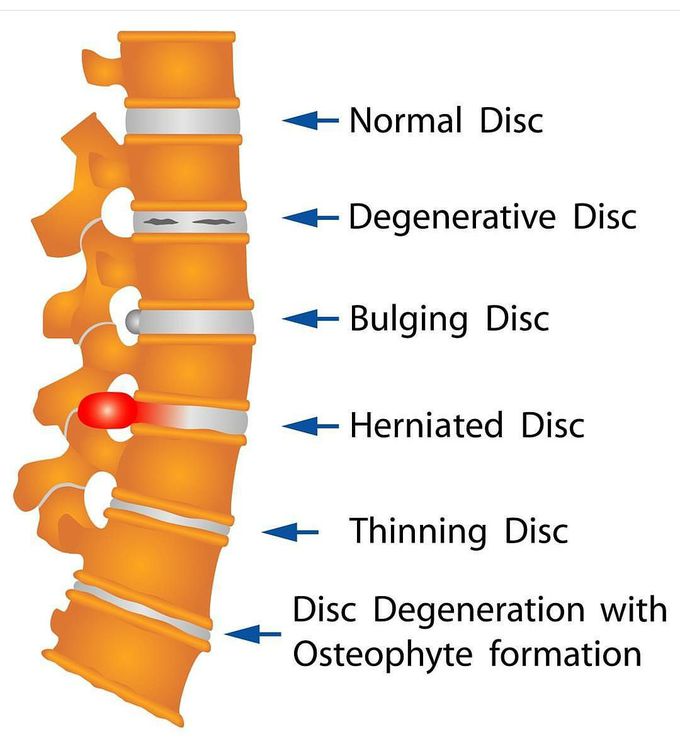 Short overview
