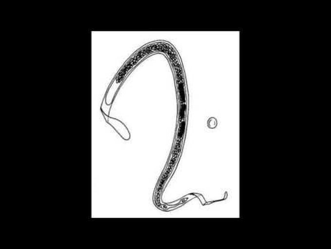 Sheathed microfilaria of nematodes- difference between Microfilariae of Wuchereria,malayi and loa