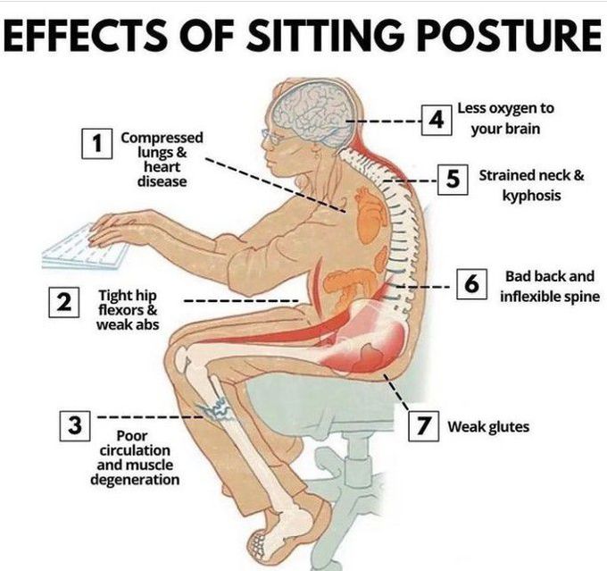 6 Most Common Causes of Poor Posture Shared By Our Stoke