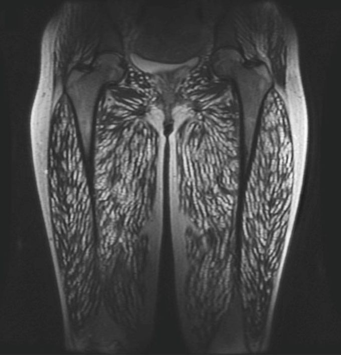 What is your diagnosis???