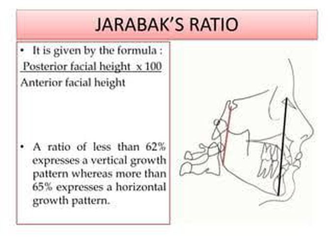 Jarabak's Ratio