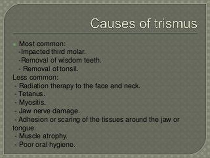Causes of Trismus