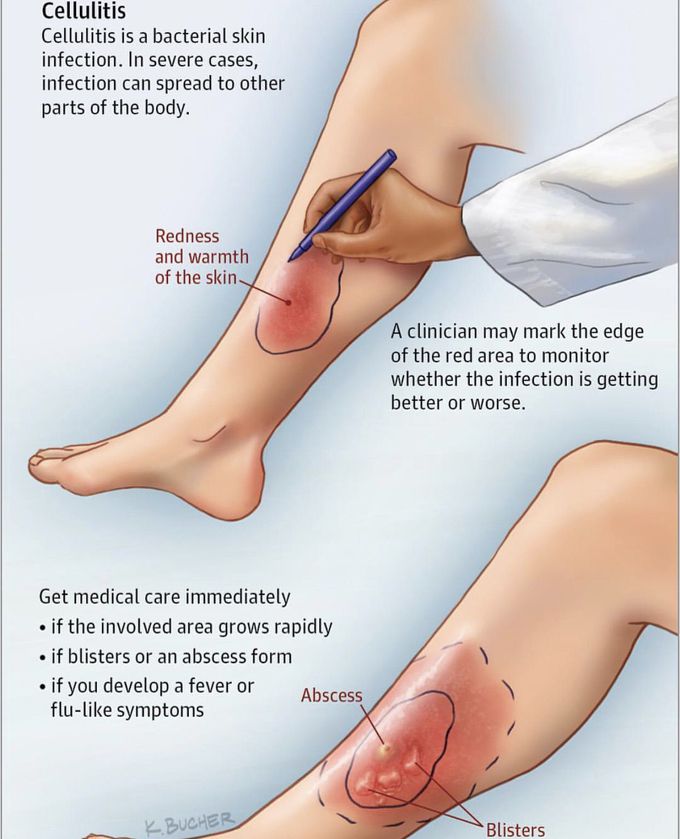 Its All about skin 👨‍⚕️👨‍⚕️