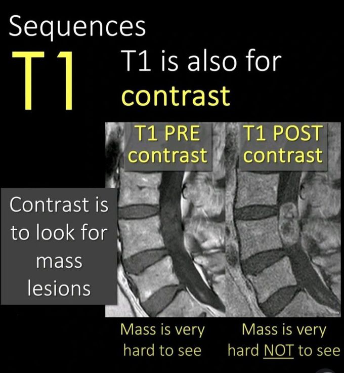 How to Read MRI II