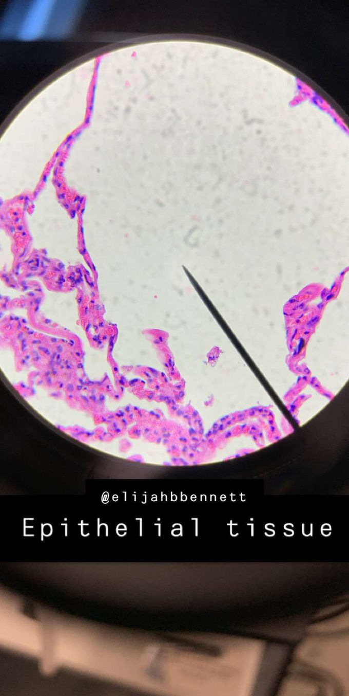 Microscopic view of epithelial tissue