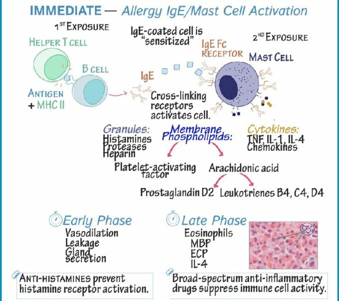 Immediate_ allergy   IgE