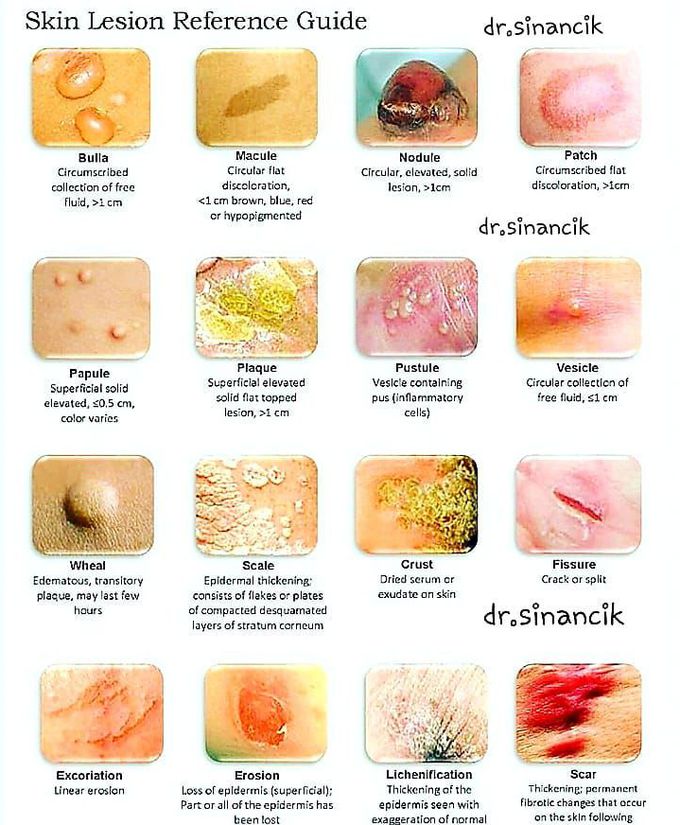 Basic terminology of dermatology