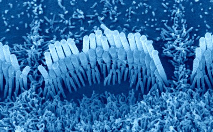 Long-Sought Hearing Channel Protein Found