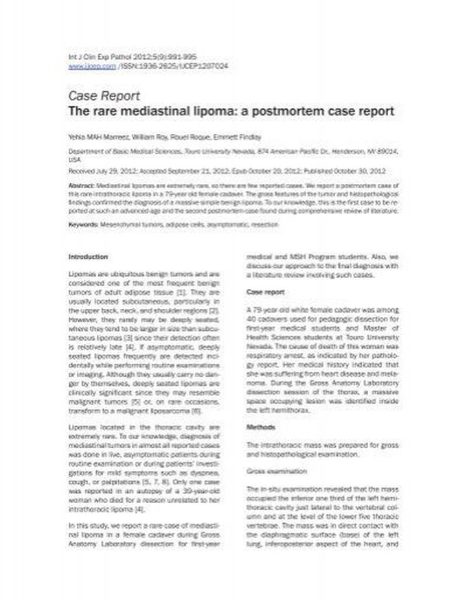 Case Report The rare mediastinal lipoma: a postmortem case report
