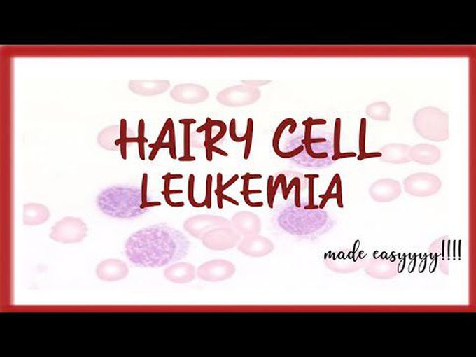 Short Review of Hairy Cell Leukaemia