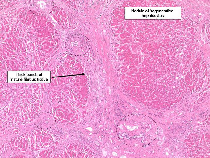 Do you recognize tissue/pathology?
