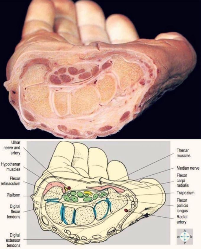 Wrist anatomy, between reality and books