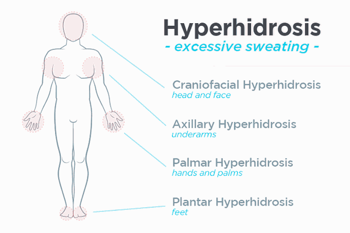 Types of hyperhidrosis