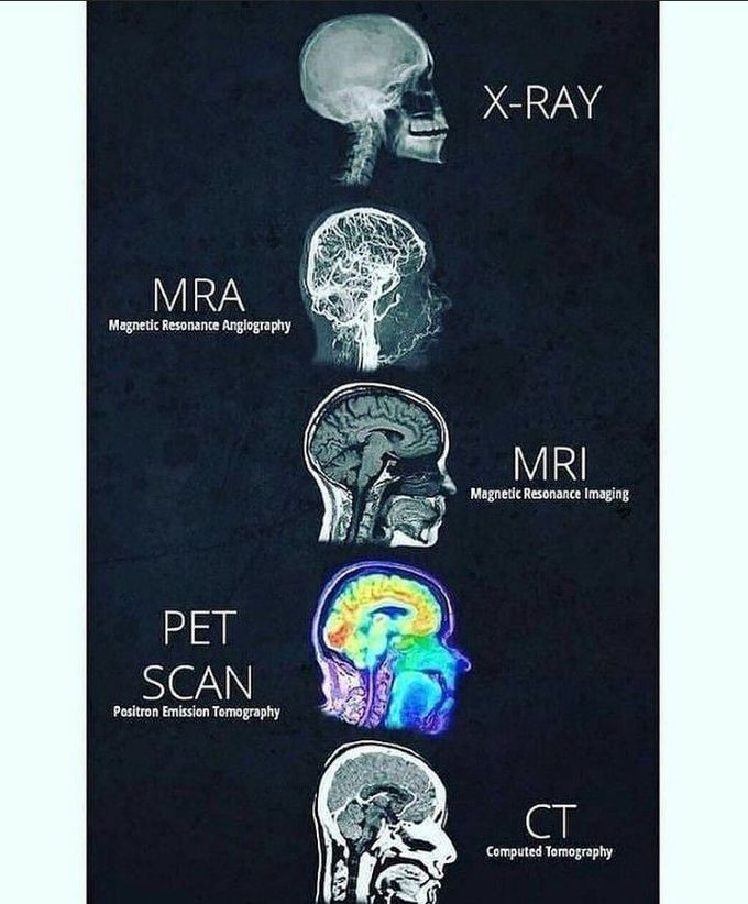 Different methods of radiology imaging