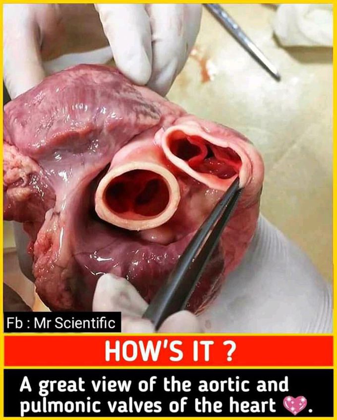 Aortic and pulomic valves