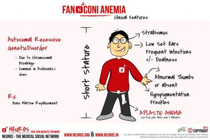 Fanconi Anemia