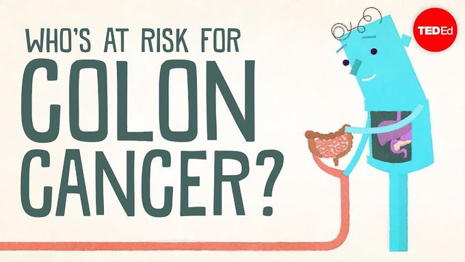 Who's at risk for colon cancer?