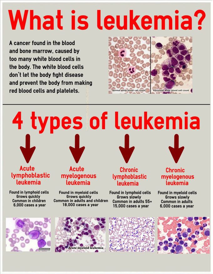 What is leukemia?