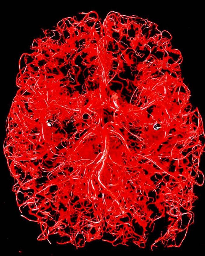 Blood vessels in human head