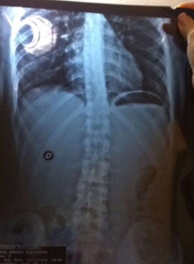 Diagnosis?