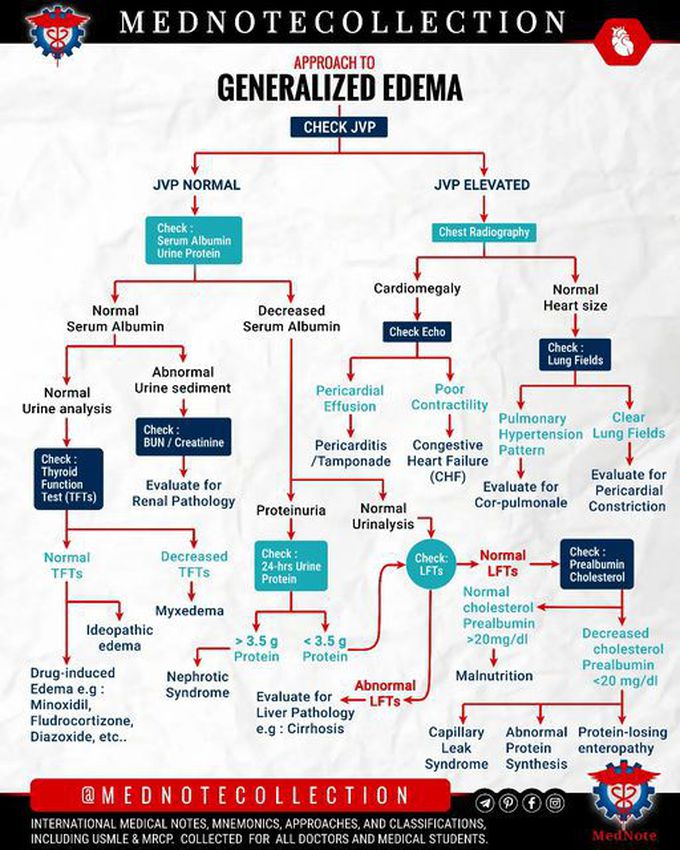 🧠 APPROACH TO GENERALIZED EDEMA