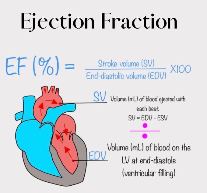 Ejection Fraction