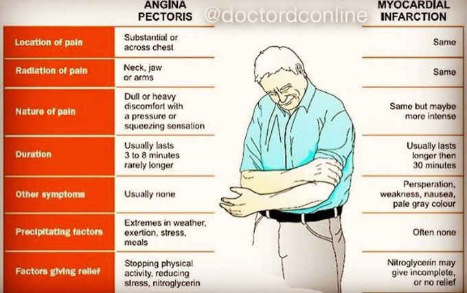 Angina pectoris vs MI !!!