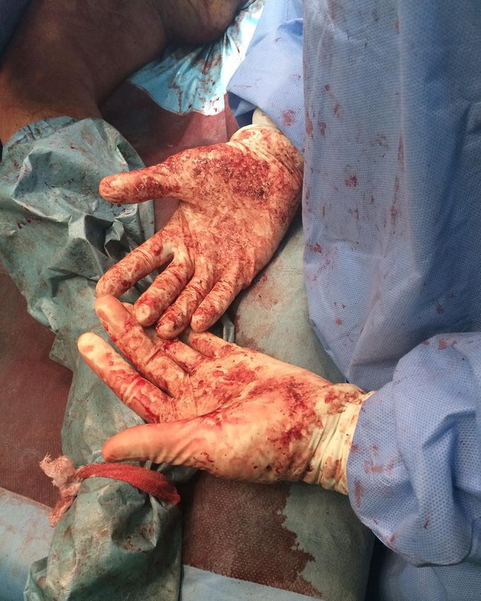 Hand of surgeon