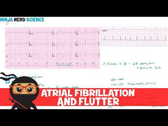 Atrial fibrillation and atrial flutter