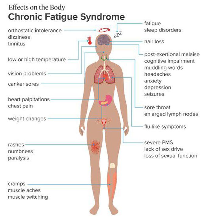 Chronic fatigue Syndrome