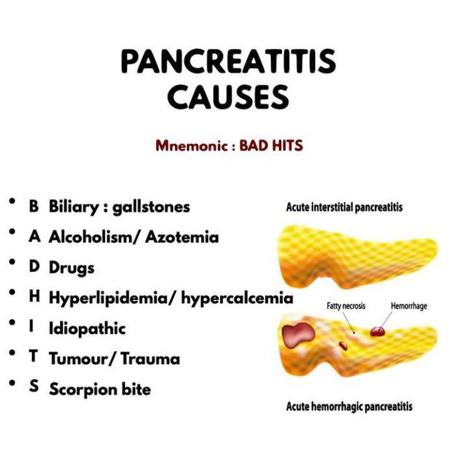 Causes of Pancreatitis MEDizzy