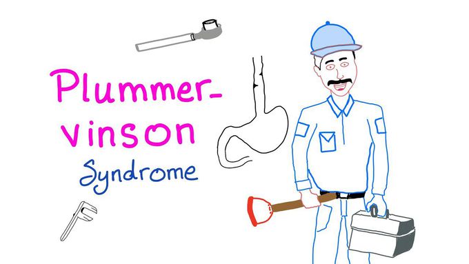Plummer-Vinson syndrome