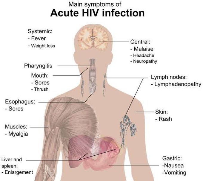 These are the symptoms of HIV infection