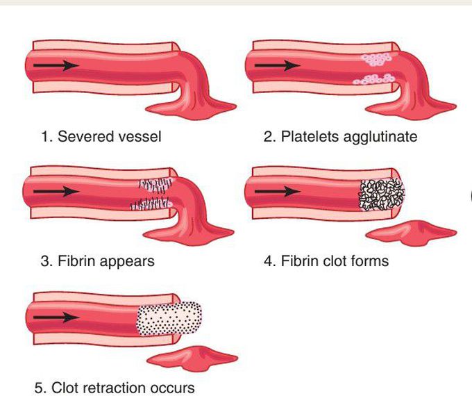 Blood clot