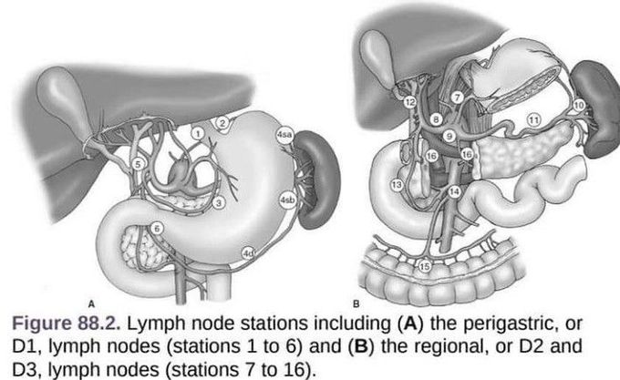 General surgery