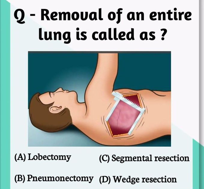 Removal of an entire Lung