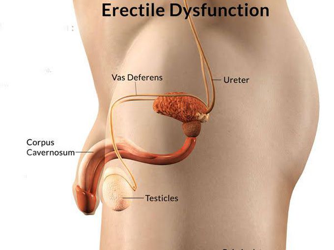 Symptoms of Erectile Dysfunction