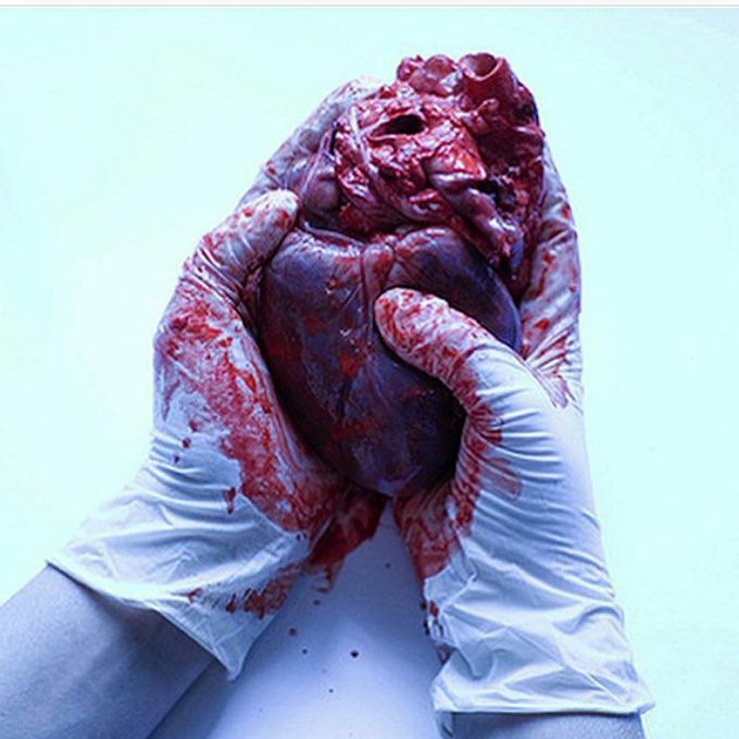 Heart