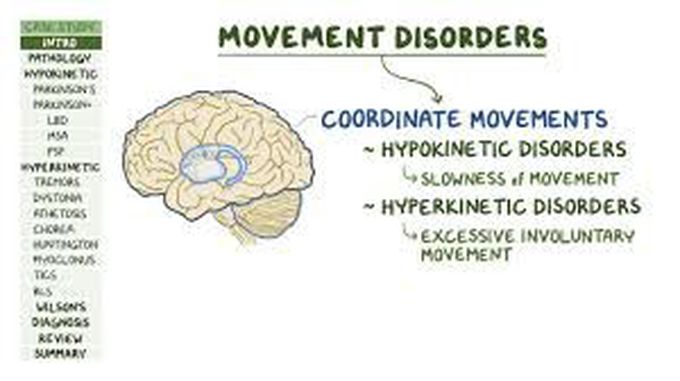 Movement disorders