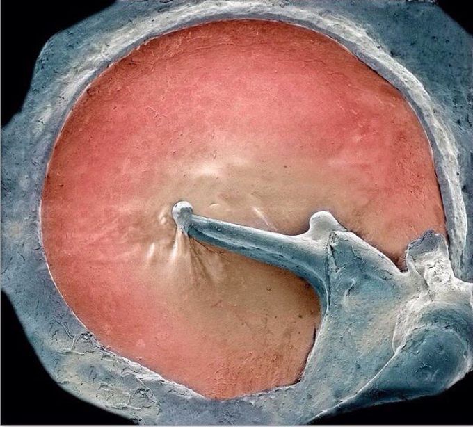 Coloured scanning electron micrograph (SEM) of an eardrum (red)