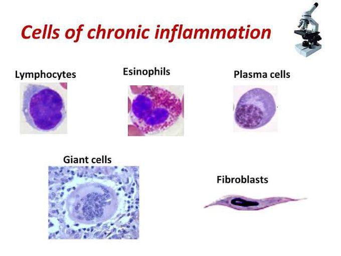 Cells of chronic inflammation